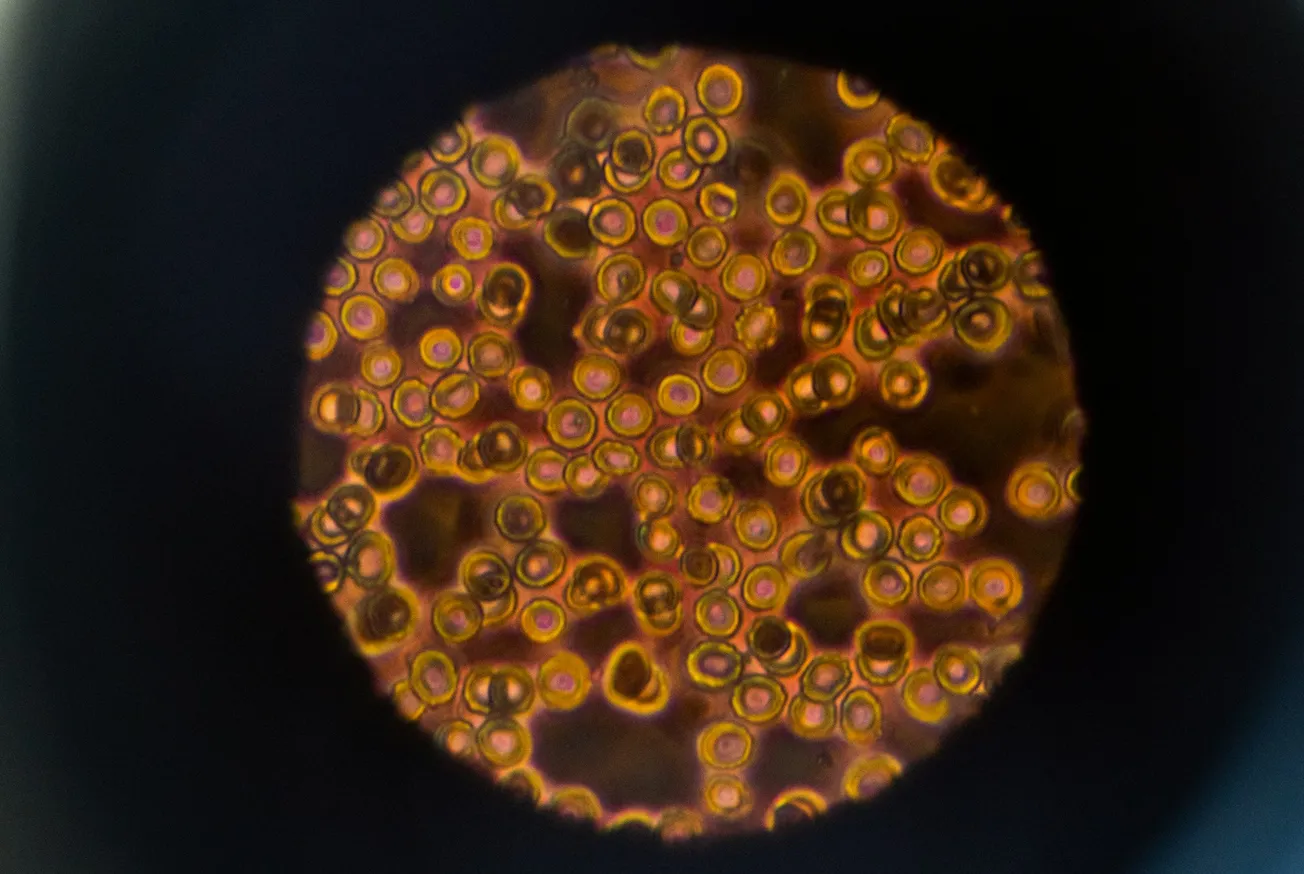 A New Age in Medicine: The Potential of Cell and Gene Therapy