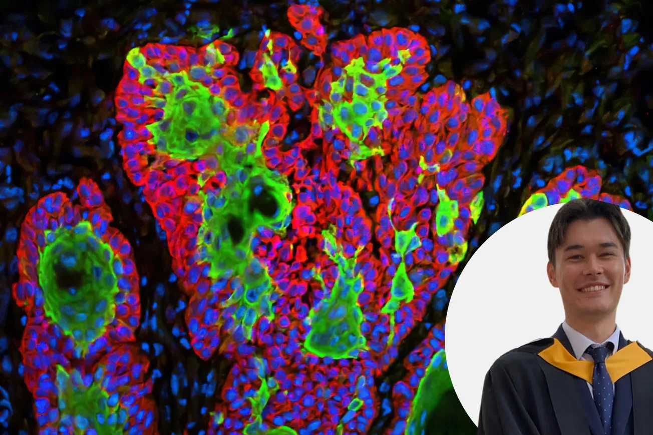 Artificial intelligence in skin cancer diagnosis: Improving diagnostics and reducing health disparity