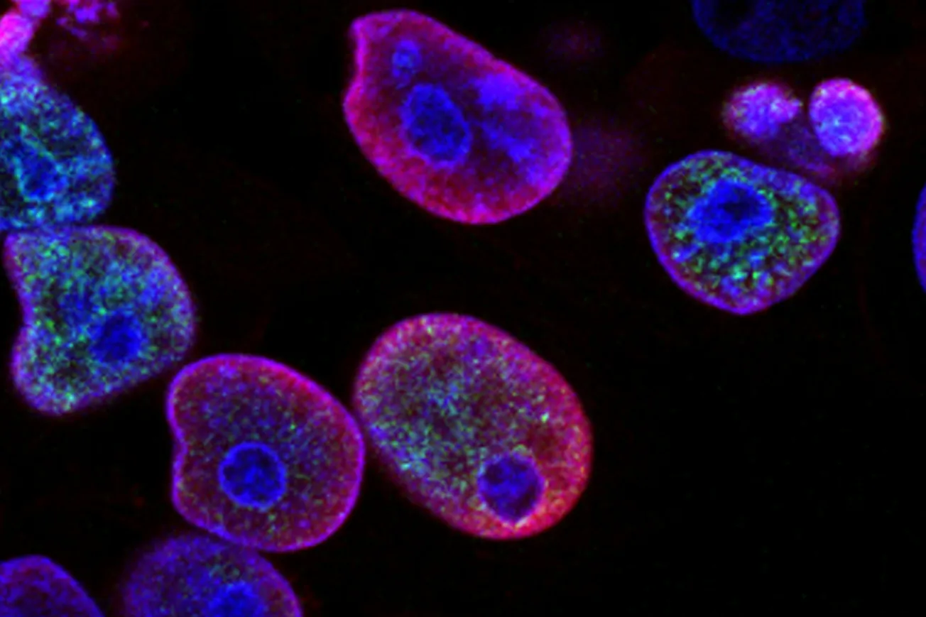 A national prostate screening programme would do more than detect cancer