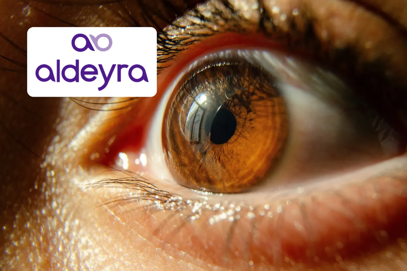 Aldeyra receives FDA complete response letter for Reproxalap